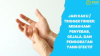 Jari Kaku atau Trigger Finger Memahami Penyebab dan Pengobatan