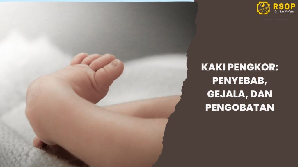 Kaki Pengkor: Penyebab, Gejala, dan Pengobatan