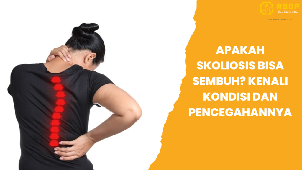 Apakah Skoliosis Bisa Sembuh? Kenali kondisi dan Pencegahannya