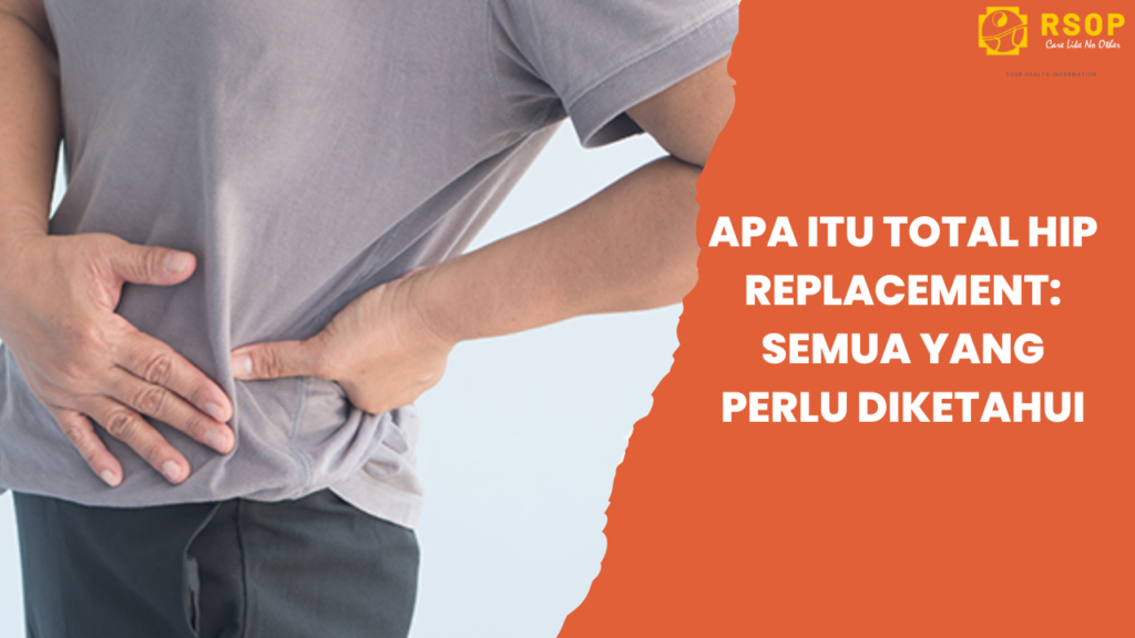 Apa Itu Total Hip Replacement: Semua yang Perlu Diketahui