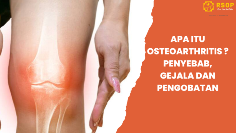 Apa-itu-Osteoarthritis