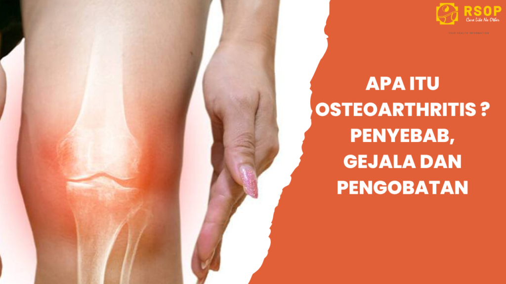 Sendi Anda Terasa Nyeri? Yuk Mengenal Lebih Dekat Dengan Osteoarthritis (Pengapuran Sendi)