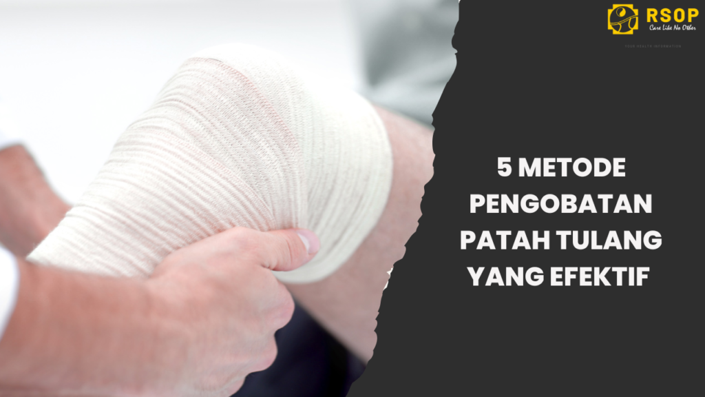 Pengobatan Patah Tulang: Cara Efektif Mengembalikan Kesehatan Tulang Anda