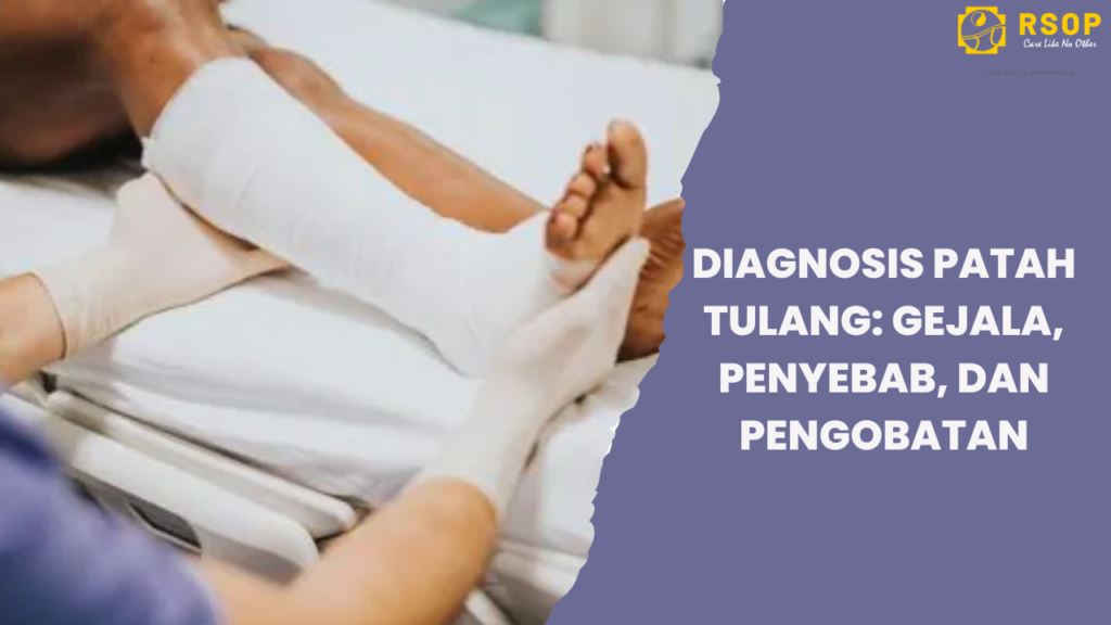 Diagnosis Patah Tulang: Gejala, Penyebab, dan Pengobatan