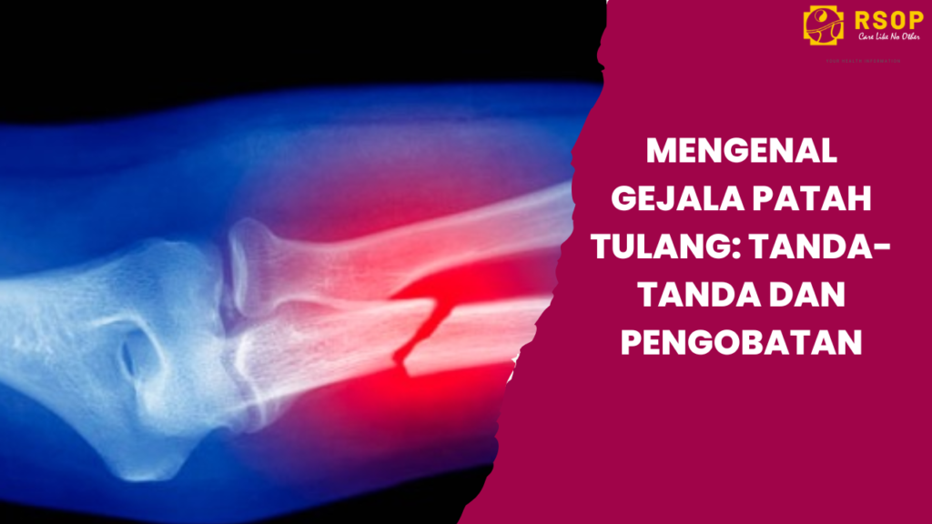 Mengenal Gejala Patah Tulang Tanda-tanda dan Pengobatan