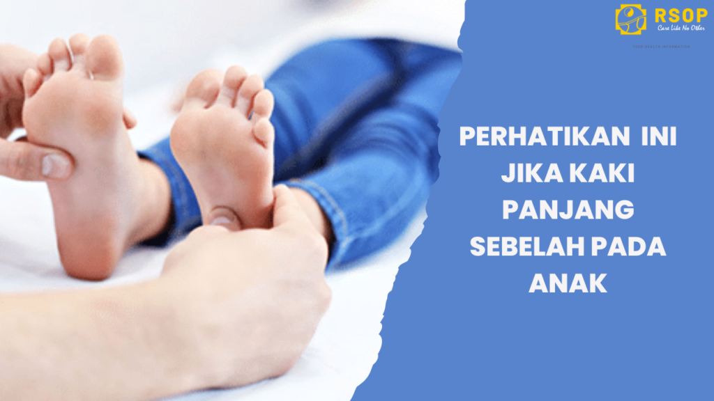 Kenali Gejala Kaki Panjang Sebelah Pada Anak