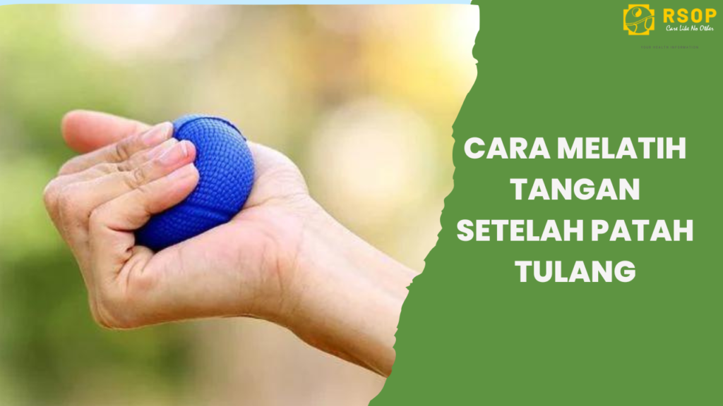 Cara Melatih Tangan Setelah Patah Tulang