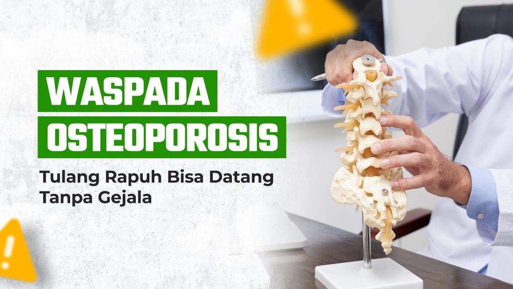 Waspada Osteoporosis! Tulang Rapuh Bisa Datang Tanpa Gejala